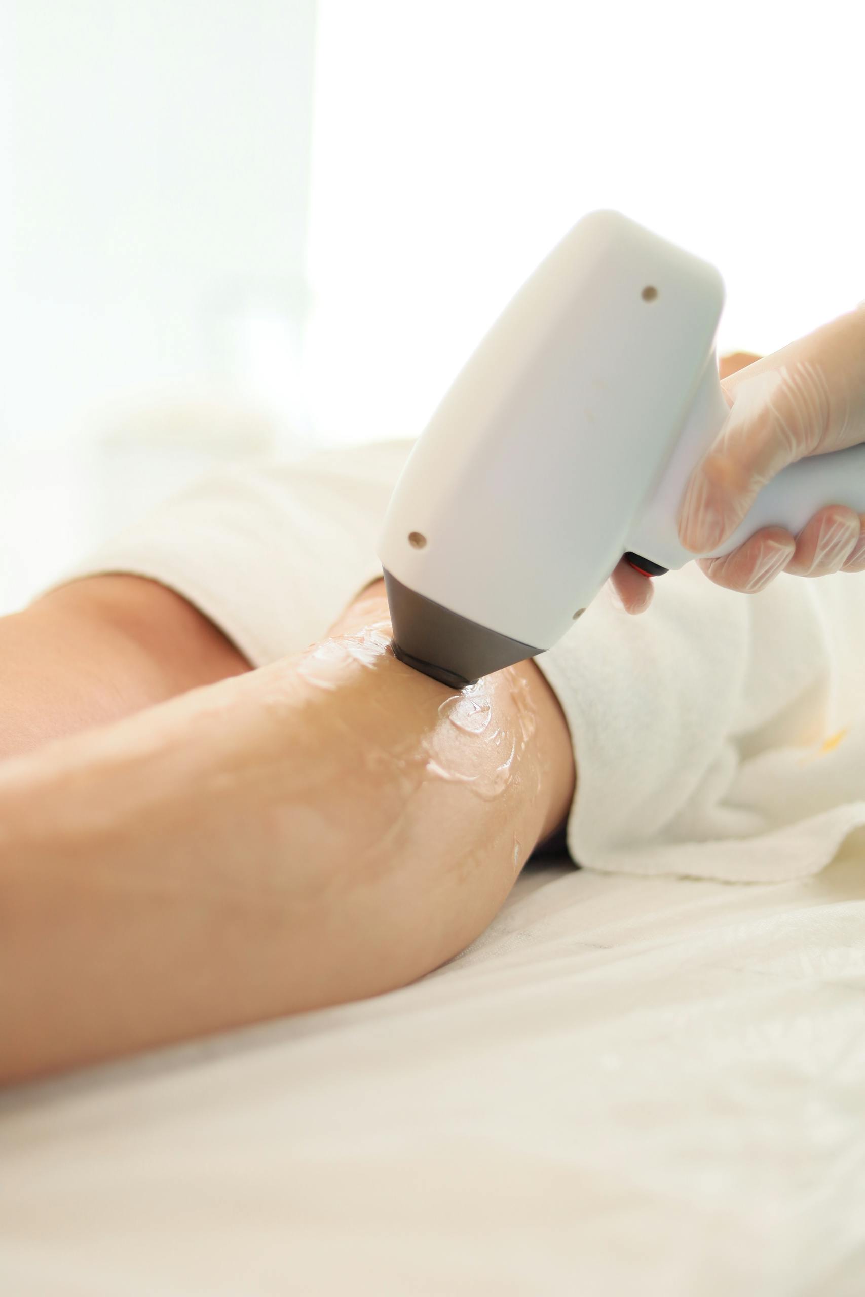 Epilation définitive laser sur jambes chez So Beauty à Remich